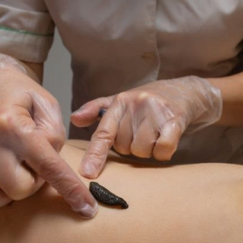 Фото з портфоліо фахівця Олена Боднар (фізіотерапевт, Чернівці)