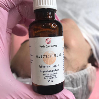 Чистка обличчя+хімічний пілінг!