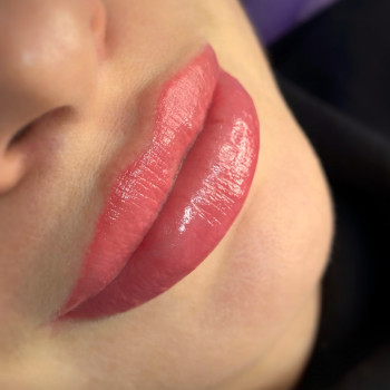 Гарні губки після збільшення.1мл препарату!
 #увеличениегуб #контурнапластикагуб