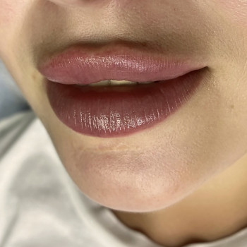 Збільшення губ,в авторській техніці.