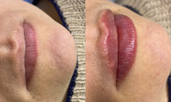 Увеличение губ Мастер перманентного макияжа Ольга Новикова Харьков