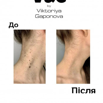 V&G, Вишневе Фото - 5