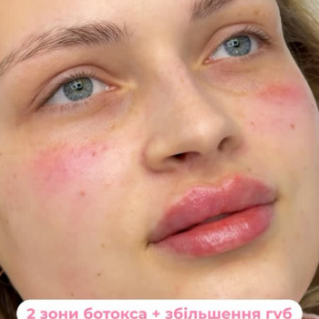 Anreal, Київ Фото - 5