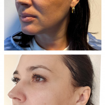 Татьяна Цюпенко, Николаев Фото - 6