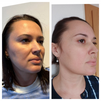 Татьяна Цюпенко, Николаев Фото - 4