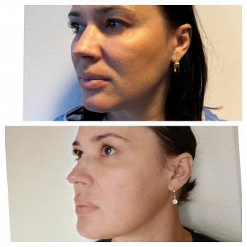 Татьяна Цюпенко, Николаев Фото - 3