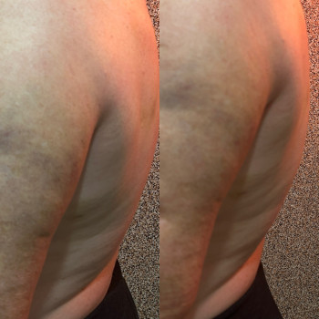 Лікувальний масаж з комплексним підходом.