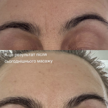 Масаж обличчя