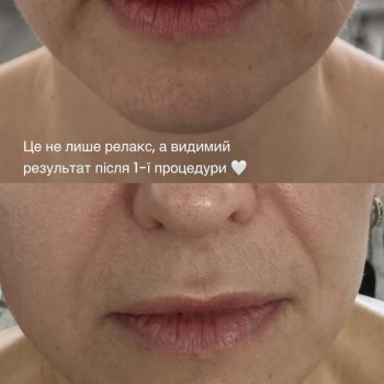 Масаж обличчя