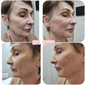 Фото с портфолио Олена Гевко