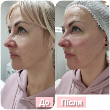 Фото с портфолио Олена Гевко