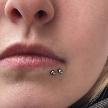 Укус павука