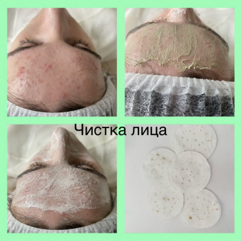 Чистка обличия