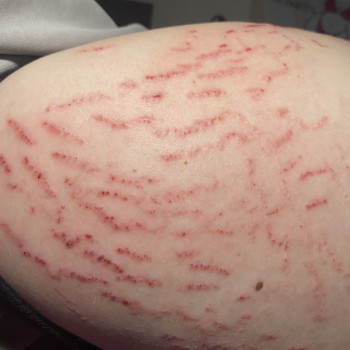 Мікронідлінг
                    Електролог Юлія Знам'янка