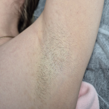 Електроепіляція
                    Майстер епіляції  Кам'янське