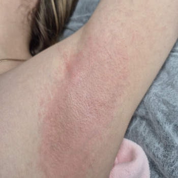 Електроепіляція
                    Майстер епіляції  Кам'янське