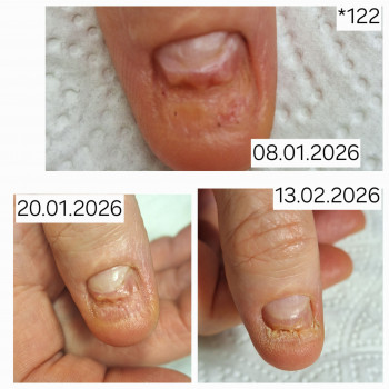 Анжела Владимировна Кротенко, Кропивницкий Фото - 8