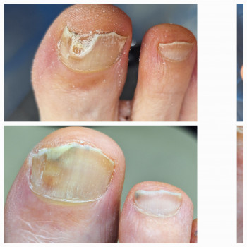 Анжела Владимировна Кротенко, Кропивницкий Фото - 9