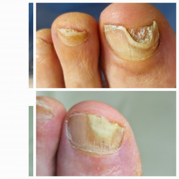 Анжела Владимировна Кротенко, Кропивницкий Фото - 10