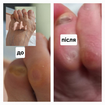 Анжела Владимировна Кротенко, Кропивницкий Фото - 11