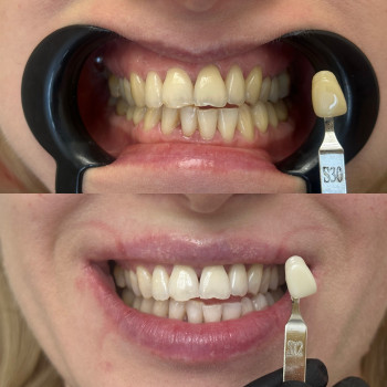 Фото из портфолио косметолога Руслана Хворостенко (Черкассы)