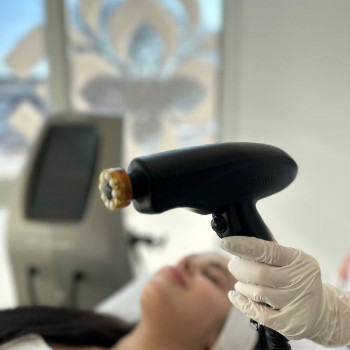 Платформа PrimeX — це інноваційна розробка Alma Lasers. 
RF - ліфтинг нового покоління, із найпотуж...