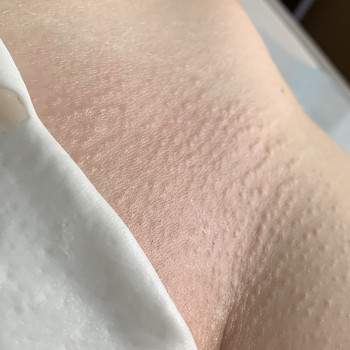 Наталья Половец, Черноморск Фото - 7