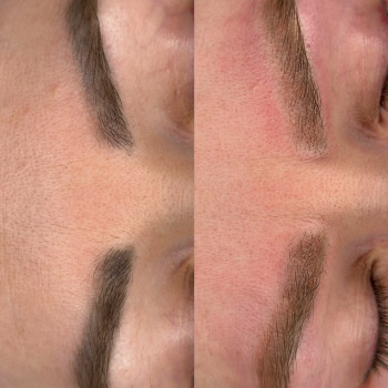 Анна Петровська, Буча Фото - 4