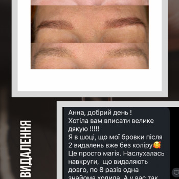 Анна Петровська, Буча Фото - 3