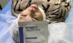 Пиллинг лица и шеи Мастер перманентного макияжа Ольга Харьков