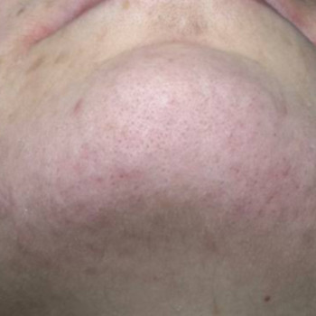 Іра Мирошниченко, Запорожье Фото - 1