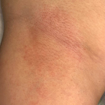 Катерина Овчаренко, Кременчуг Фото - 7