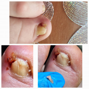 Анжела Владимировна Кротенко, Кропивницкий Фото - 7