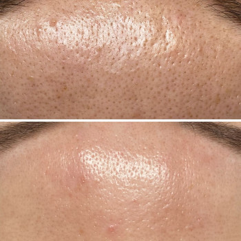 Катерина Поповська, Харків Фото - 4