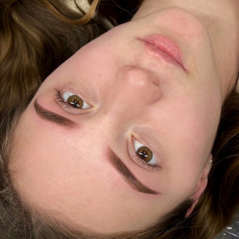 Перманент брів, поновлення через 1,5 року після первинної процедури.