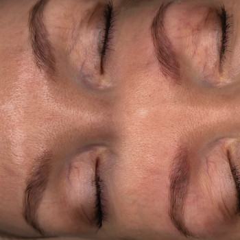 Видалення старого перманентного макіяжу ремувером.