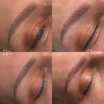 Видалення старого перманенту брів ремувером.