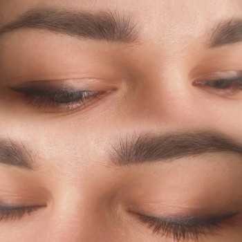 Загоєні брови через 1 рік