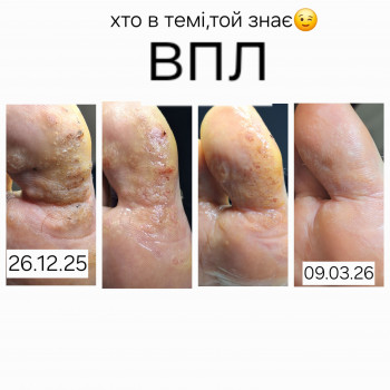 Анжела Владимировна Кротенко, Кропивницкий Фото - 5