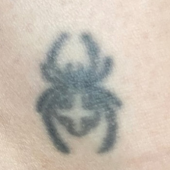 До перекриття