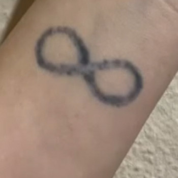 До перекриття