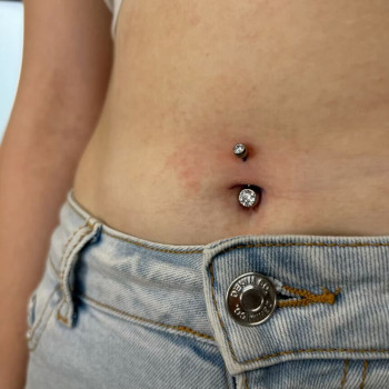 пірсинг пупка з врахуванням анатомічних особливостей пацієнтки - вона вдячна і задоволена - все швид...