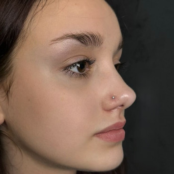 пірсинг носа виконаний настільки професійно, що пацієнтка не відчула болю і все швидко загоїлось