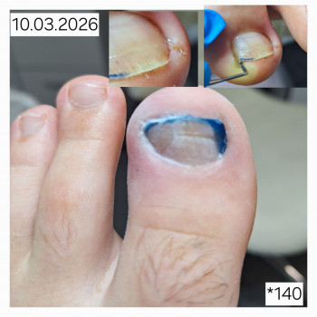 Анжела Владимировна Кротенко, Кропивницкий Фото - 4