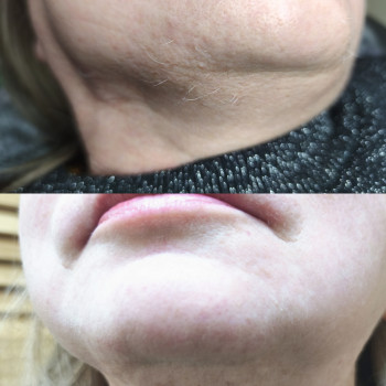 Ірина Бондар, Житомир Фото - 5