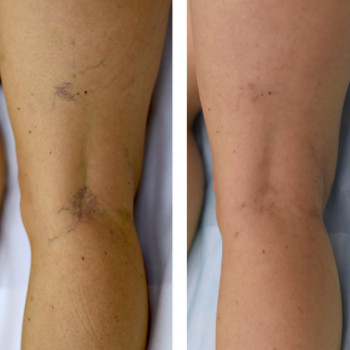 В'ячеслав Гончаров, Київ Фото - 5