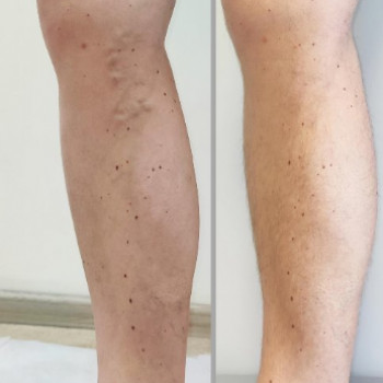 Сергей Войцицкий, Киев Фото - 5