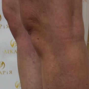 Фото из портфолио специалиста Александр Романенко (флеболог, Хмельницкий)