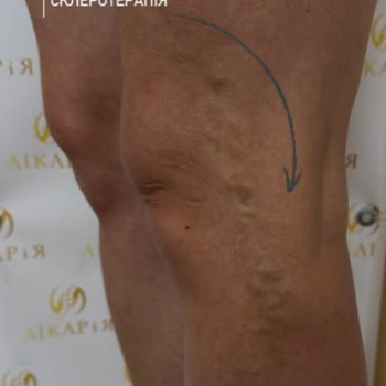 Фото из портфолио специалиста Александр Романенко (флеболог, Хмельницкий)