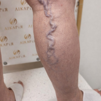 Фото из портфолио специалиста Александр Романенко (флеболог, Хмельницкий)